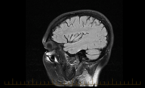 Side of my head scan